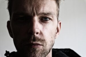 ビューティースキンクリニックでの剃り残しについて知恵袋での質問は？
